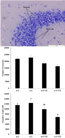 Impact of Fish Oil and Vitamin E Maternal Mice Dietary Supplementation on Offspring’s Testis and Brain Development and Function